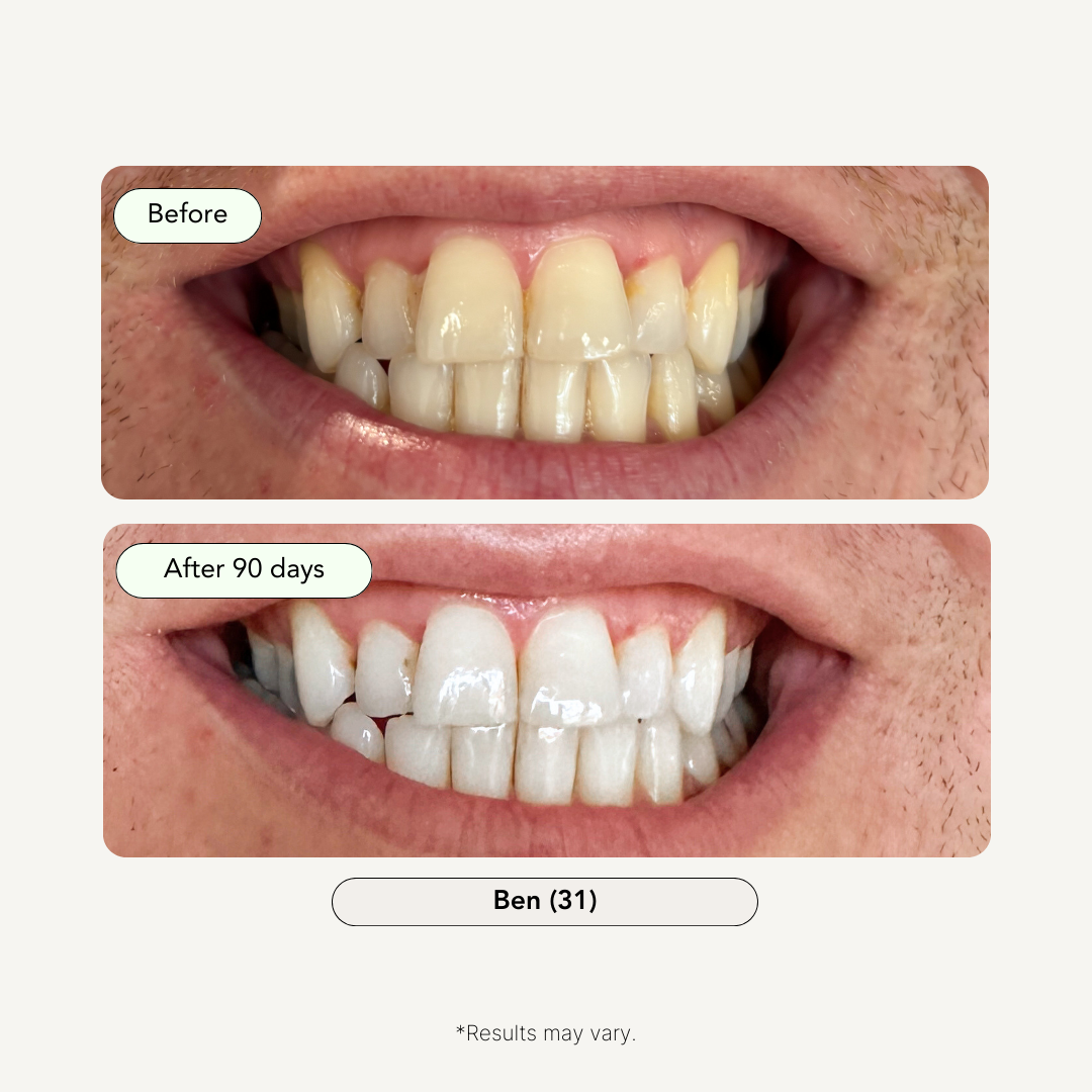 3-Step Coconut Charcoal Oral Care and Whitening Kit