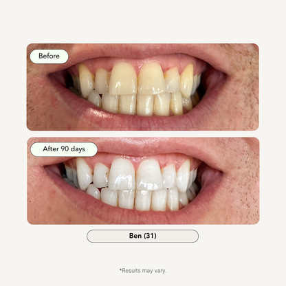 3-Step Coconut Charcoal Teeth Whitening Kit